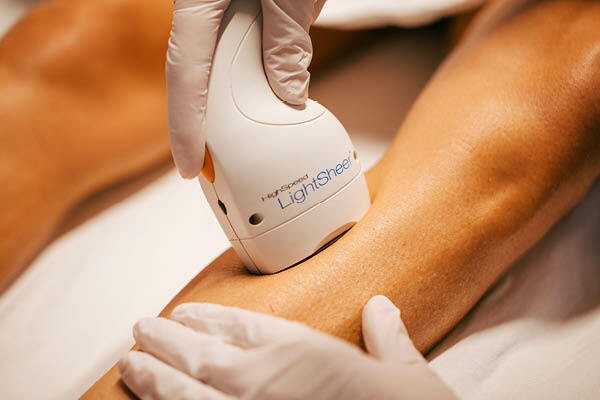 De Voordelen van Laseren van Haren: Een Permanente Oplossing voor Ongewenste Haargroei